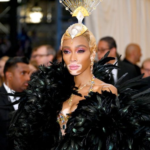 Met Gala. 2019. Winnie Harlow